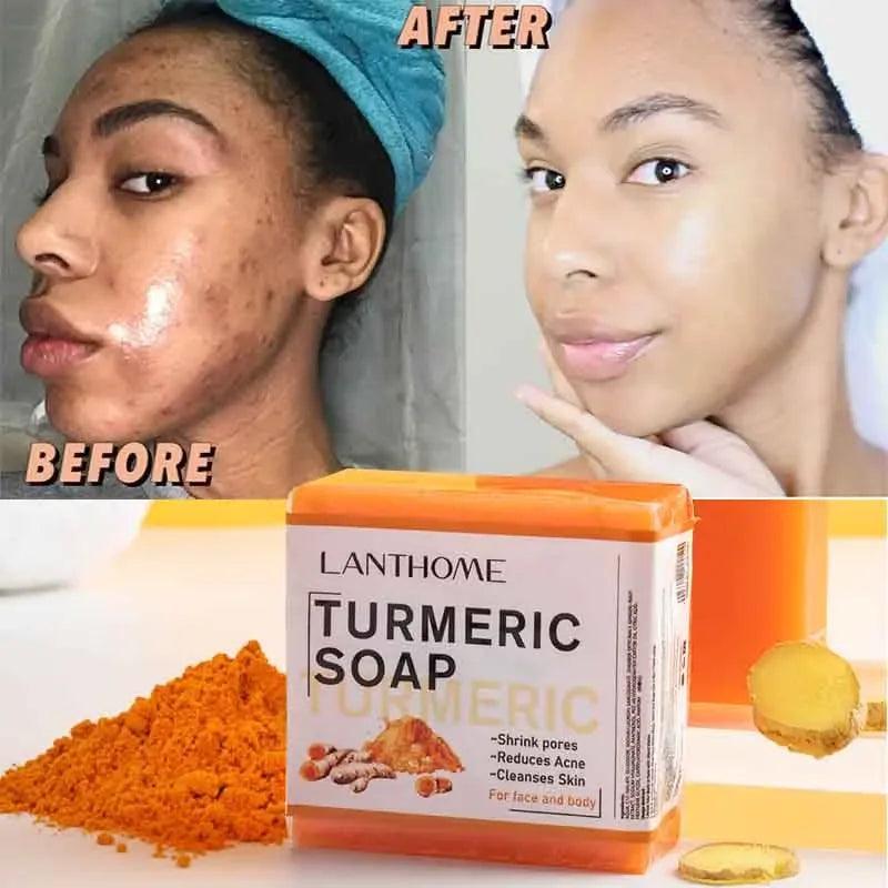 Turmeric Soap Anti Acne - IM PERKY Boutique