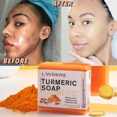 Turmeric Soap Anti Acne - IM PERKY Boutique